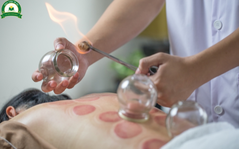 Học Cao đẳng Y học cổ truyền là gì?