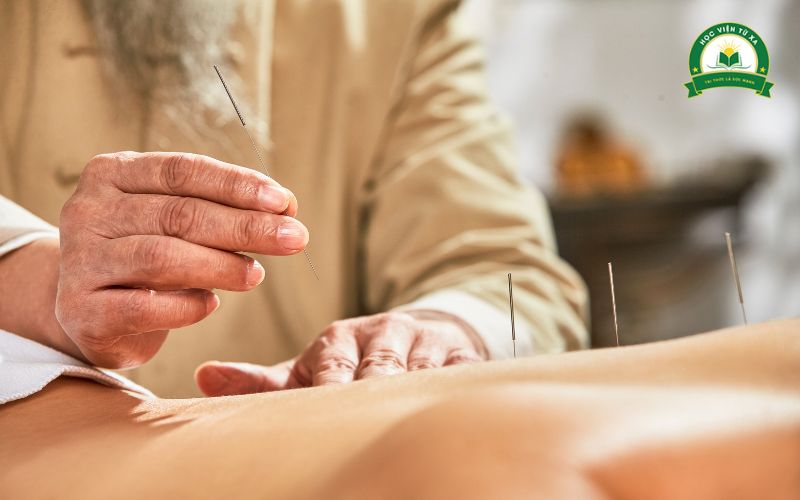 Lý do nên học Trung cấp Y học cổ truyền